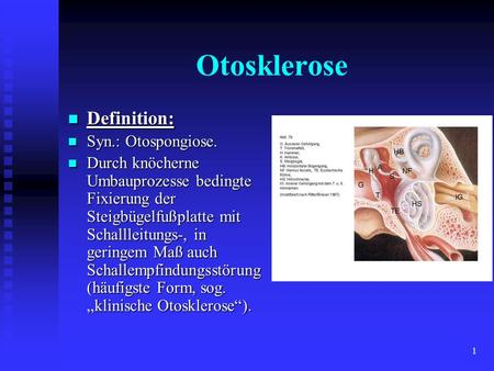 Otosklerose Definition: Syn.: Otospongiose.