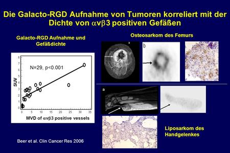 Die Galacto-RGD Aufnahme von Tumoren korreliert mit der Dichte von v 3 positiven Gefäßen MVD of v 3 positive vessels SUV 8 7 6 5 4 3 2 1 0 05101520253035.