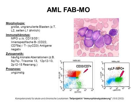 AML FAB-MO CD33/CD7+ cyLF-/MPO+