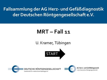 Fallsammlung der AG Herz- und Gefäßdiagnostik der Deutschen Röntgengesellschaft e.V. MRT – Fall 11 U. Kramer, Tübingen START.