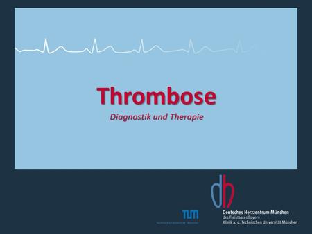 Thrombose Diagnostik und Therapie