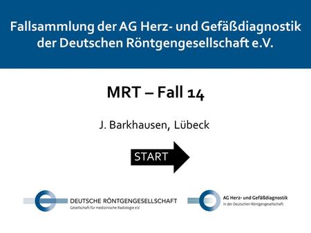 Fallsammlung der AG Herz- und Gefäßdiagnostik der Deutschen Röntgengesellschaft e.V. MRT – Fall 14 J. Barkhausen, Lübeck START.