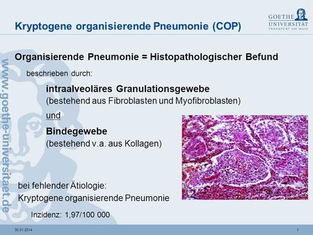 Kryptogene organisierende Pneumonie (COP)