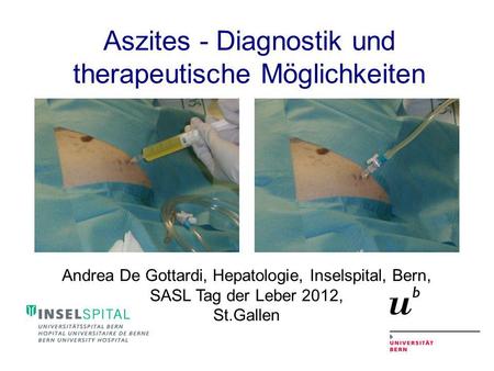 Aszites - Diagnostik und therapeutische Möglichkeiten