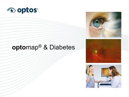 Optomap® & Diabetes 1.