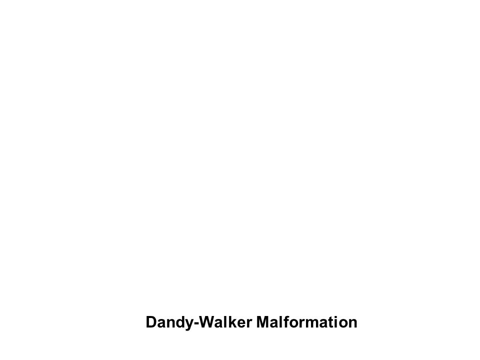 Dandy-Walker Malformation