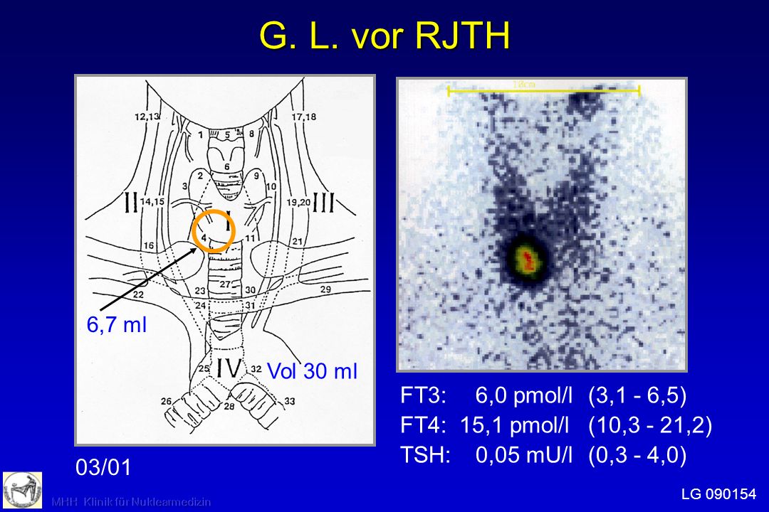 G. L. vor RJTH FT3: 6,0 pmol/l (3,1 - 6,5)
