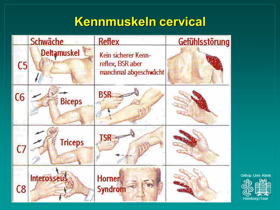 Kennmuskeln cervical Orthop. Univ. Klinik. Homburg / Saar