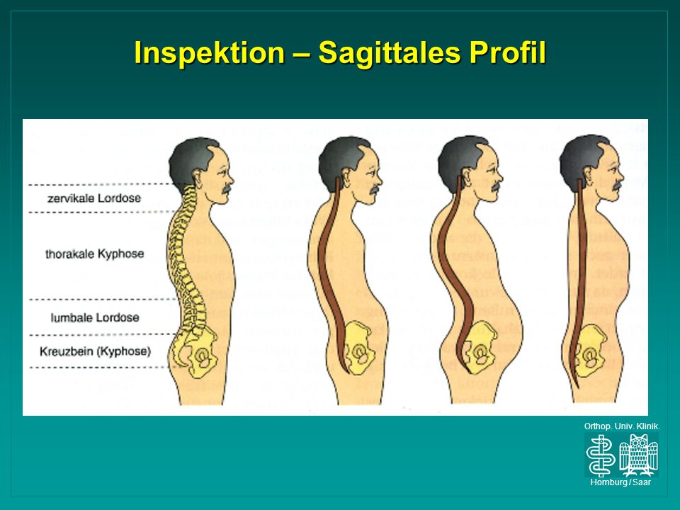Inspektion – Sagittales Profil