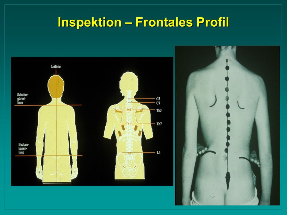 Inspektion – Frontales Profil