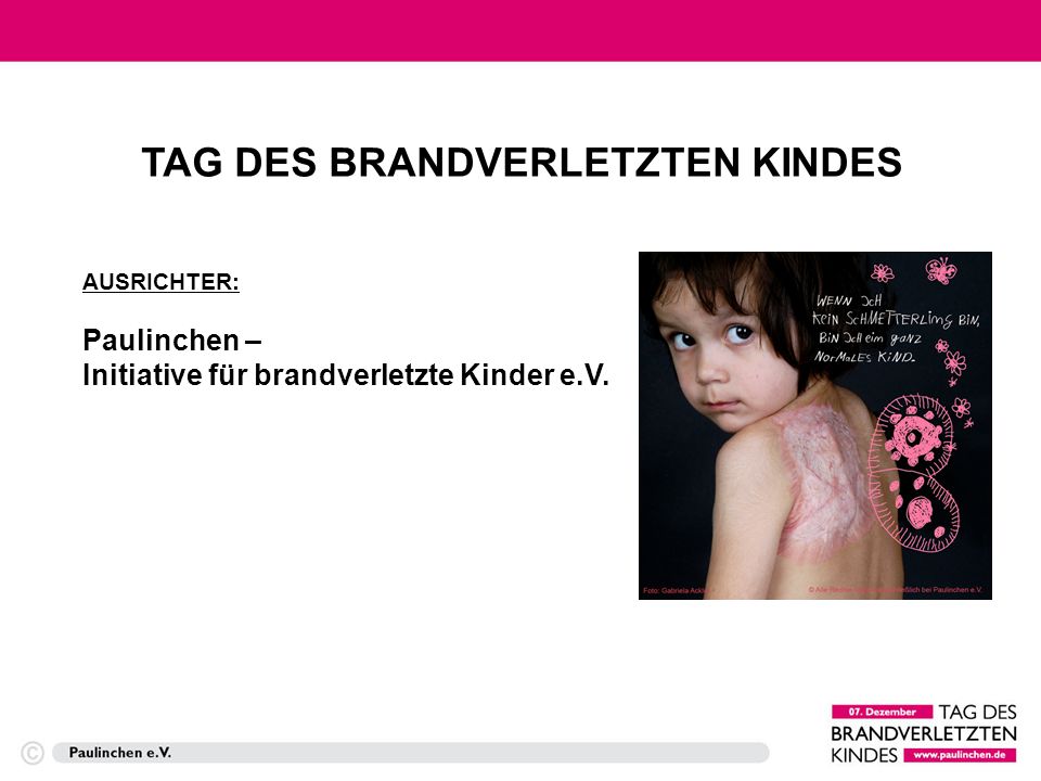 TAG DES BRANDVERLETZTEN KINDES