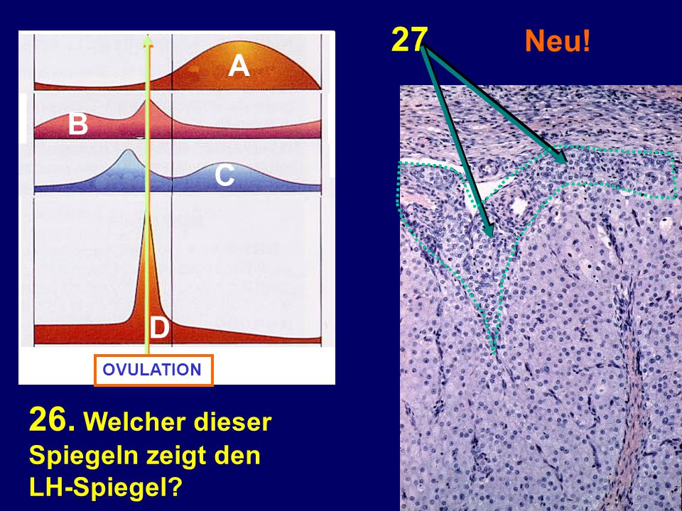 Welcher dieser Neu! A B C D Spiegeln zeigt den LH-Spiegel