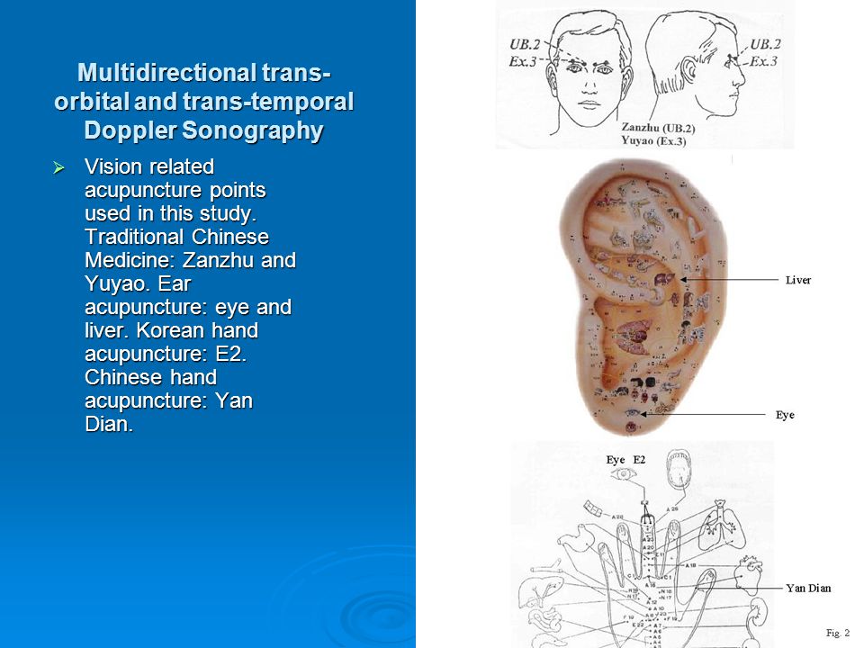 Multidirectional trans-orbital and trans-temporal Doppler Sonography
