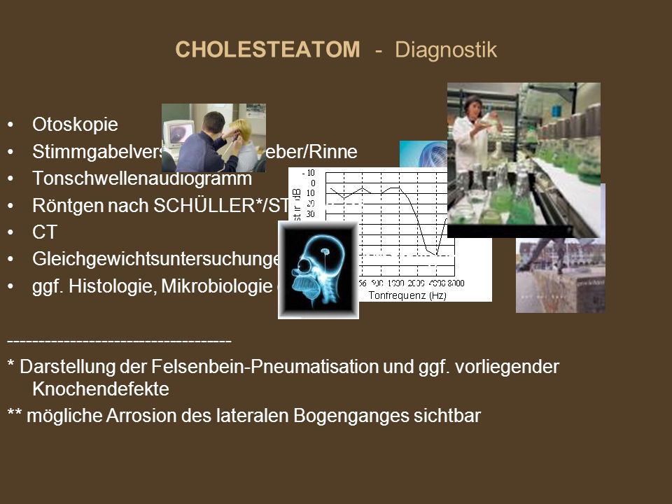 CHOLESTEATOM - Diagnostik