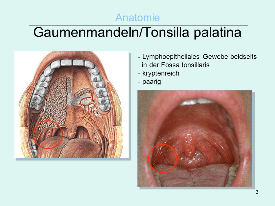 Anatomie Gaumenmandeln/Tonsilla palatina