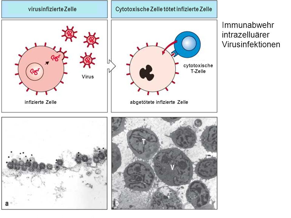 Immunabwehr intrazelluärer Virusinfektionen