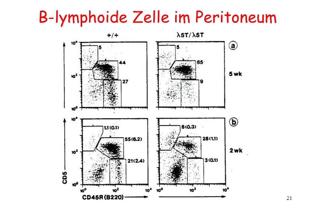 B-lymphoide Zelle im Peritoneum