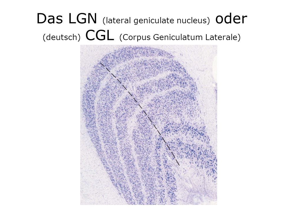 Das LGN (lateral geniculate nucleus) oder (deutsch) CGL (Corpus Geniculatum Laterale)