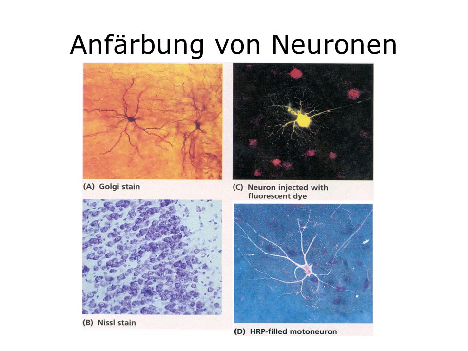 Anfärbung von Neuronen