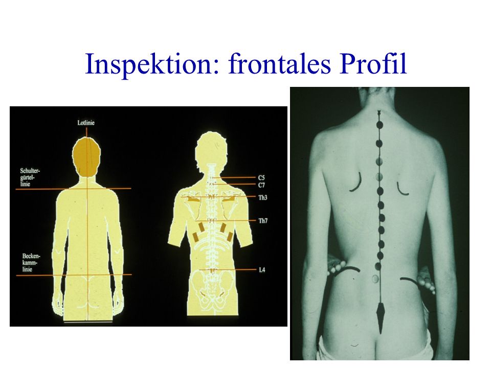 Inspektion: frontales Profil