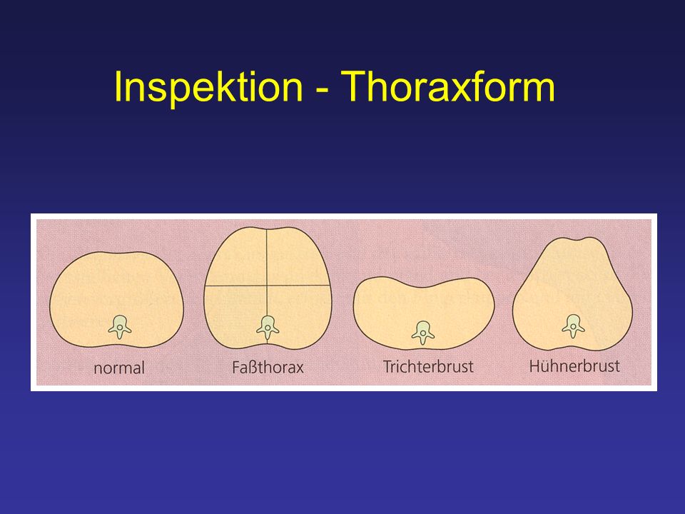 Inspektion - Thoraxform