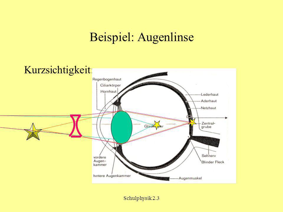 Beispiel: Augenlinse Kurzsichtigkeit: Schulphysik 2.3