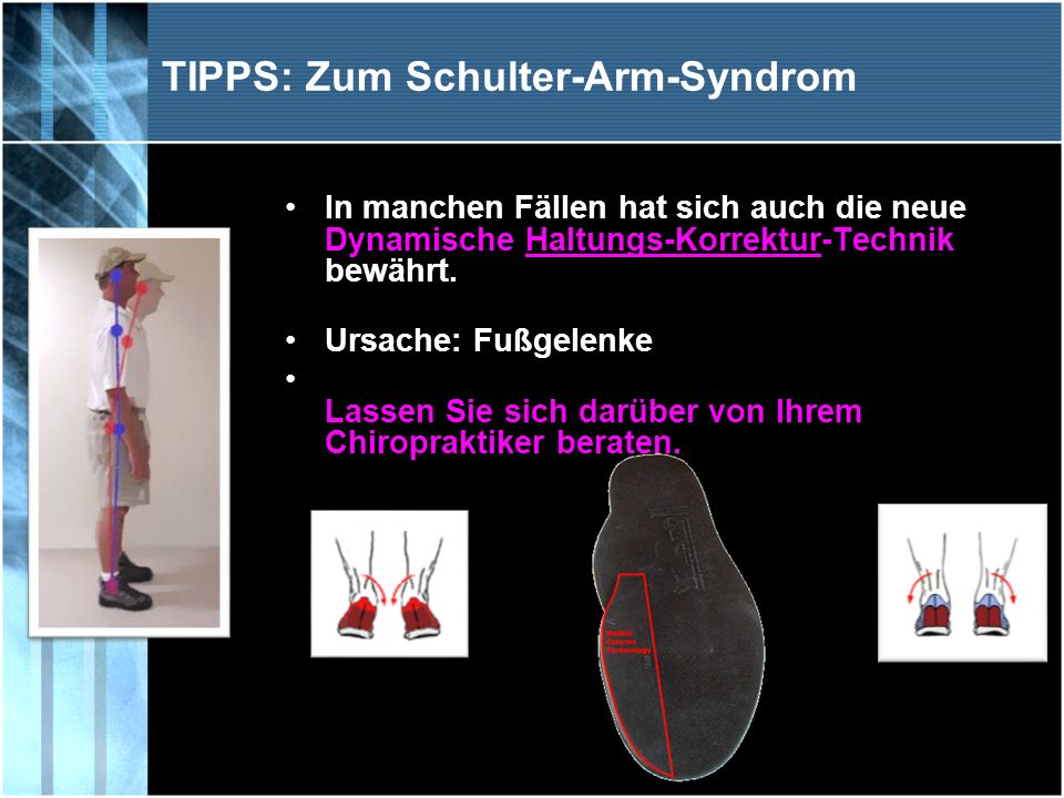 TIPPS: Zum Schulter-Arm-Syndrom