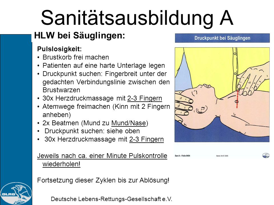 Sanitätsausbildung A HLW bei Säuglingen: Pulslosigkeit: