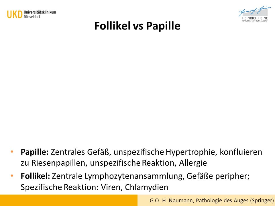 Follikel vs Papille Papille: Zentrales Gefäß, unspezifische Hypertrophie, konfluieren zu Riesenpapillen, unspezifische Reaktion, Allergie.