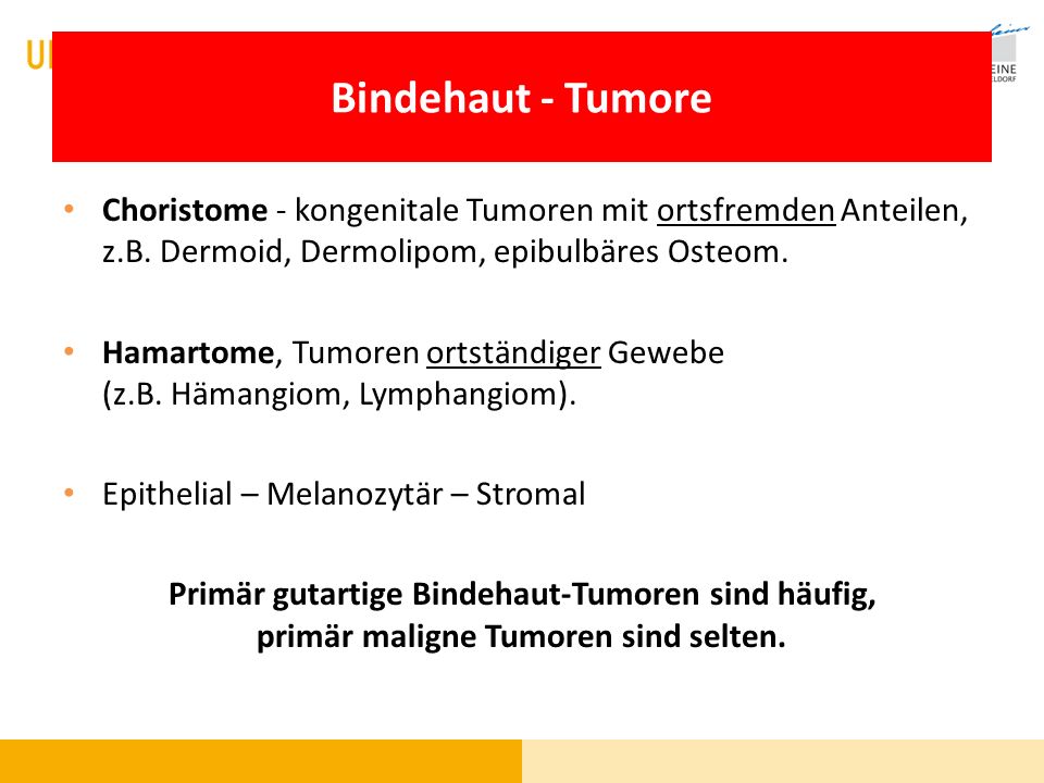 Bindehaut - Tumore Choristome - kongenitale Tumoren mit ortsfremden Anteilen, z.B. Dermoid, Dermolipom, epibulbäres Osteom.
