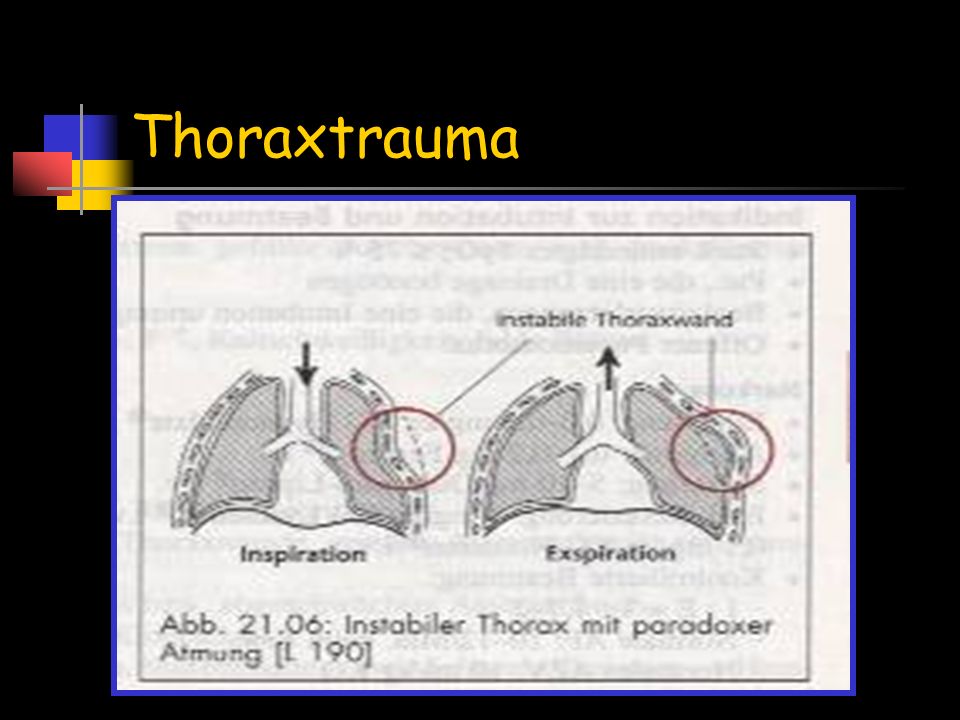 Thoraxtrauma