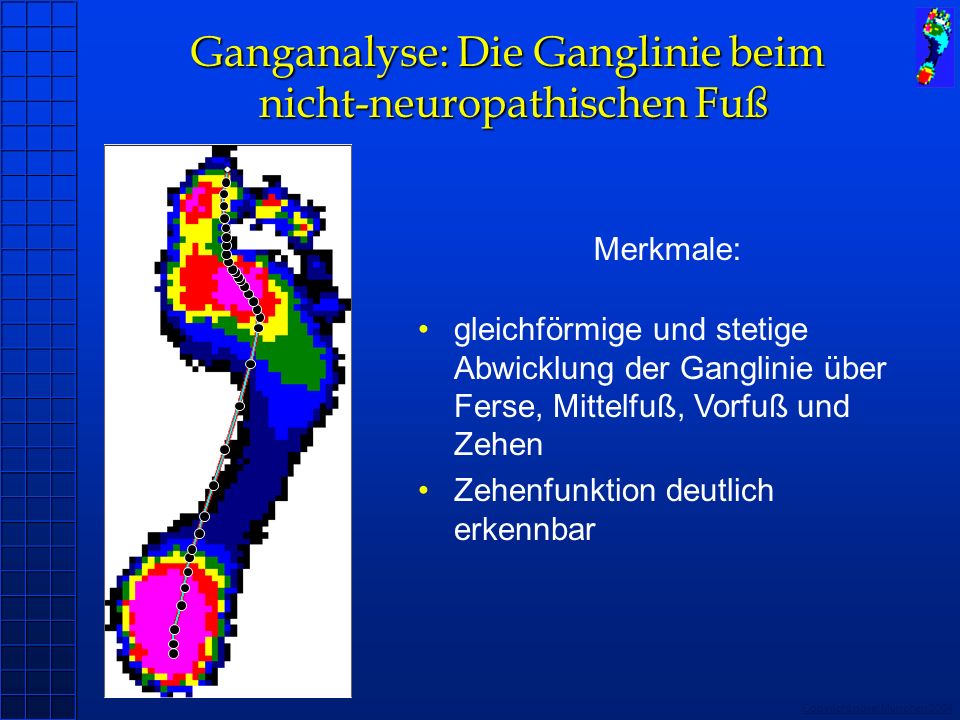 Ganganalyse: Die Ganglinie beim nicht-neuropathischen Fuß