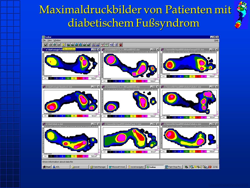 Maximaldruckbilder von Patienten mit diabetischem Fußsyndrom