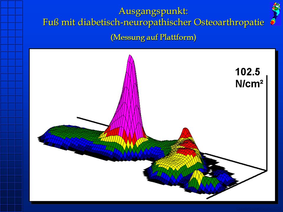 Ausgangspunkt: Fuß mit diabetisch-neuropathischer Osteoarthropatie (Messung auf Plattform)