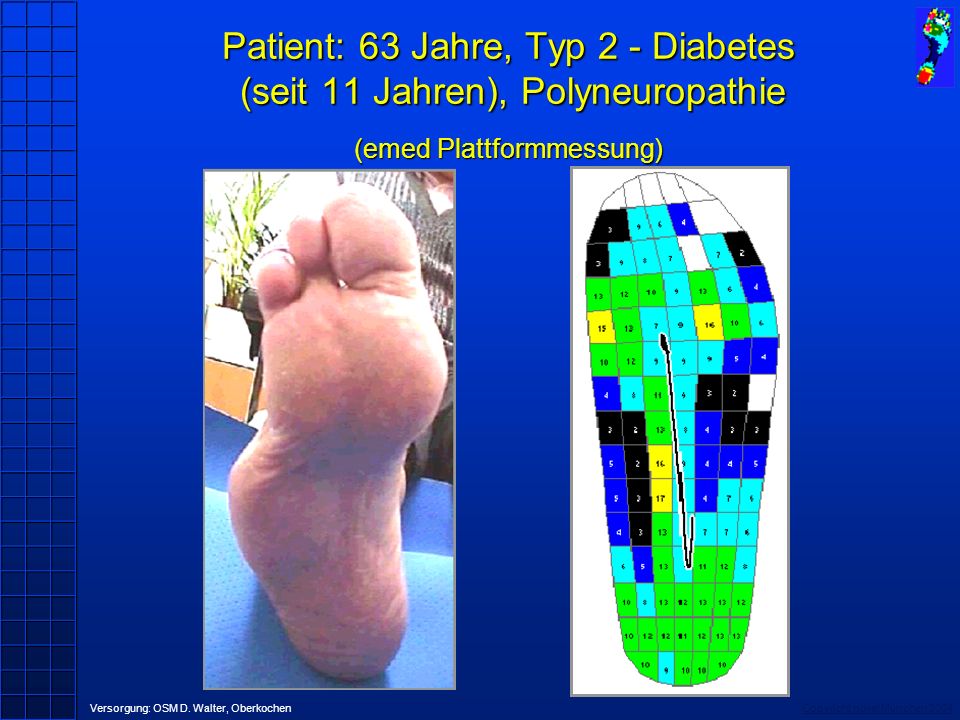Patient: 63 Jahre, Typ 2 - Diabetes (seit 11 Jahren), Polyneuropathie (emed Plattformmessung)
