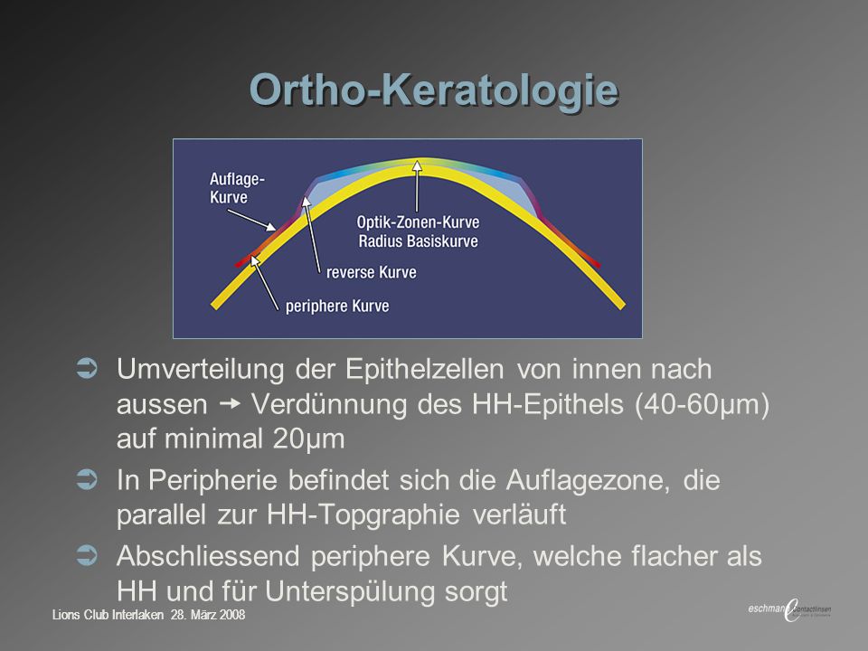 Ortho-Keratologie Umverteilung der Epithelzellen von innen nach aussen  Verdünnung des HH-Epithels (40-60μm) auf minimal 20μm.