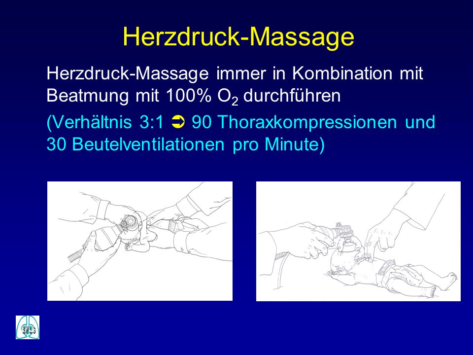 Herzdruck-Massage Herzdruck-Massage immer in Kombination mit Beatmung mit 100% O2 durchführen.