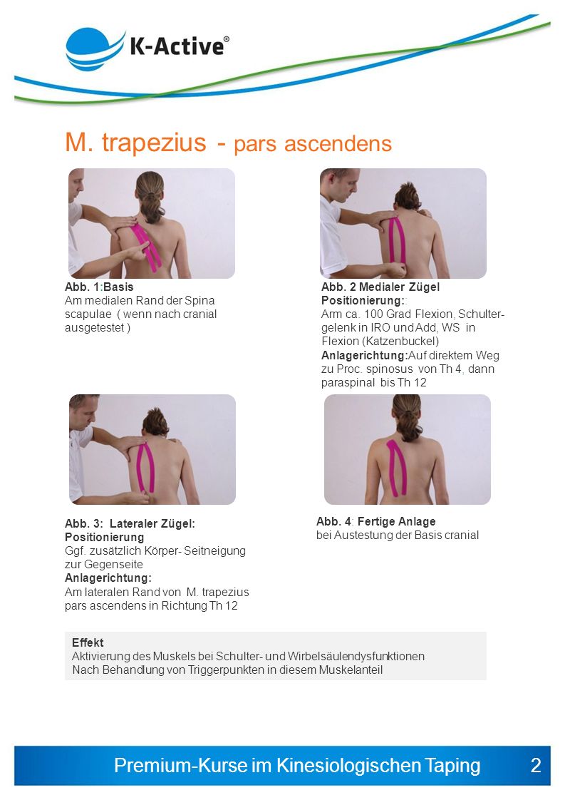 M. trapezius - pars ascendens