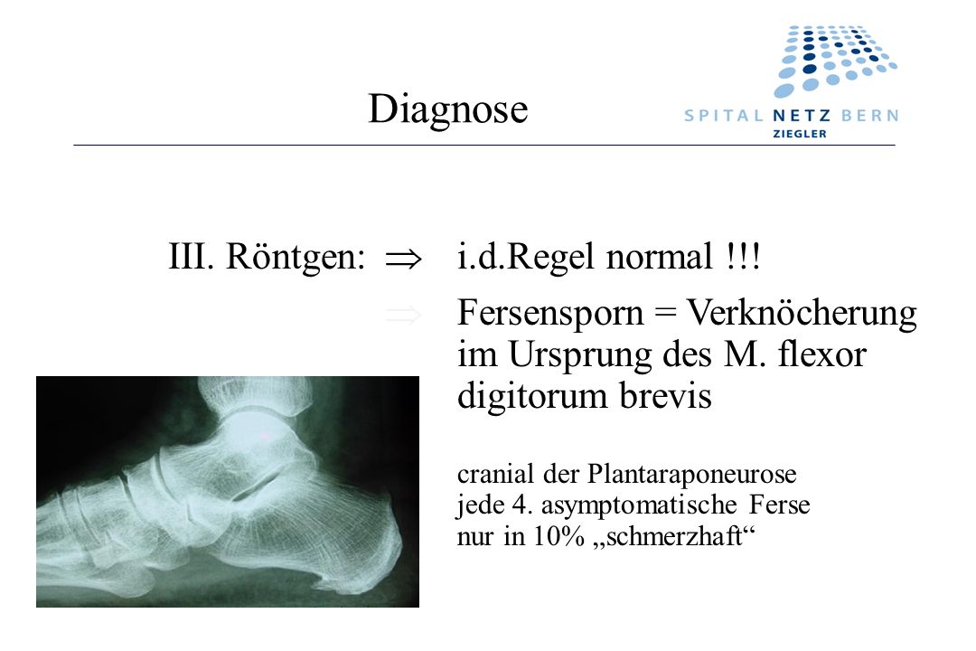 Diagnose III. Röntgen:  i.d.Regel normal !!!
