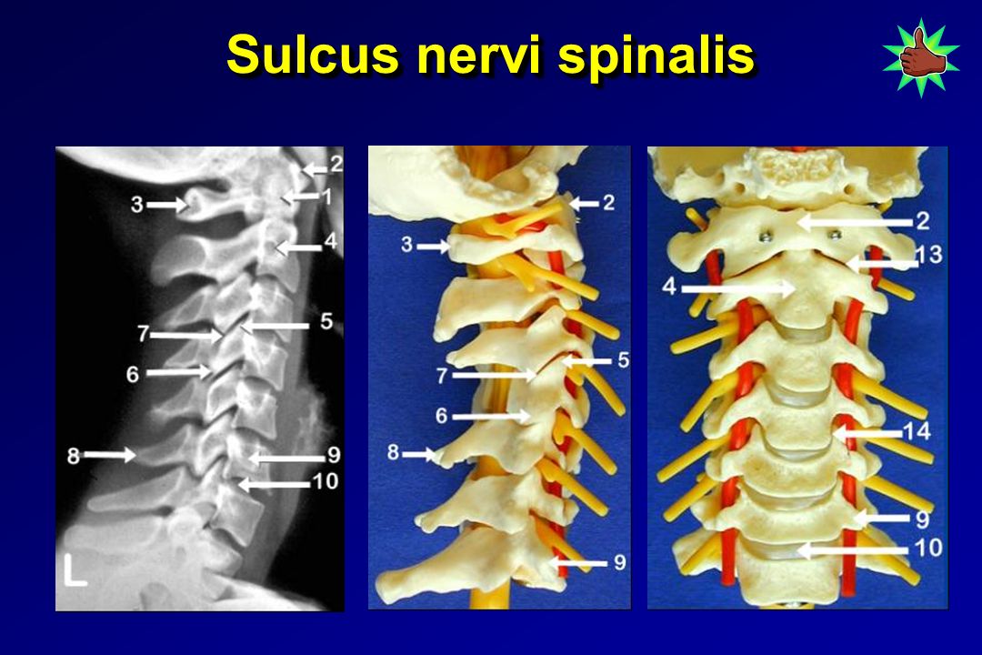 Sulcus nervi spinalis