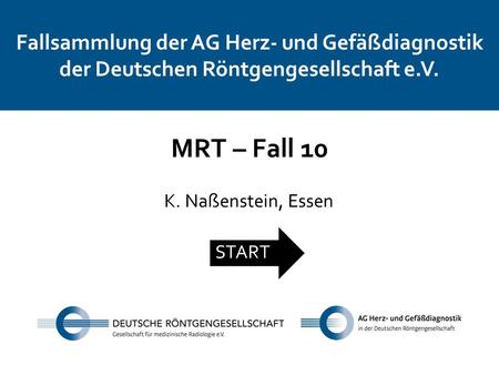 Fallsammlung der AG Herz- und Gefäßdiagnostik der Deutschen Röntgengesellschaft e.V. MRT – Fall 10 K. Naßenstein, Essen START.