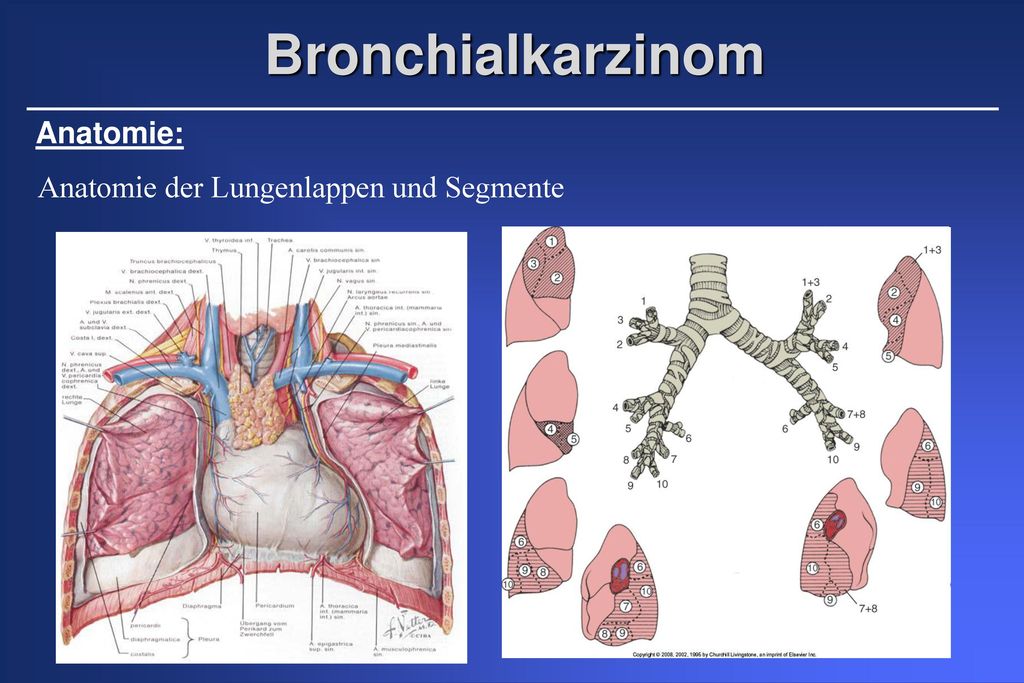 Anatomie der Lungenlappen und Segmente - ppt herunterladen