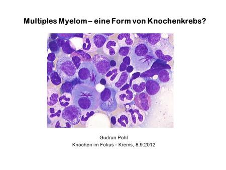 Multiples Myelom – eine Form von Knochenkrebs?