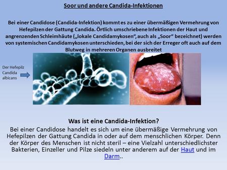 Was ist eine Candida-Infektion?