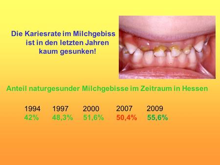 Anteil naturgesunder Milchgebisse im Zeitraum in Hessen