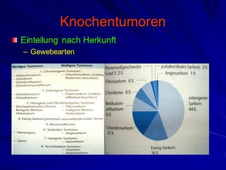 Knochentumoren Einteilung nach Herkunft Gewebearten.