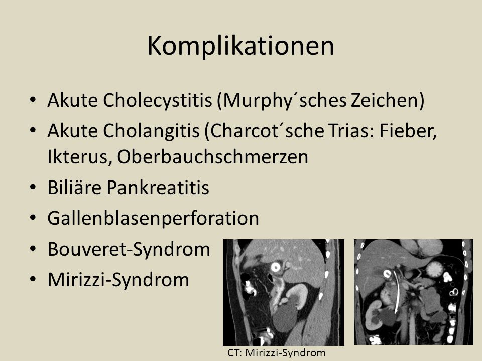 Komplikationen Akute Cholecystitis (Murphy´sches Zeichen)