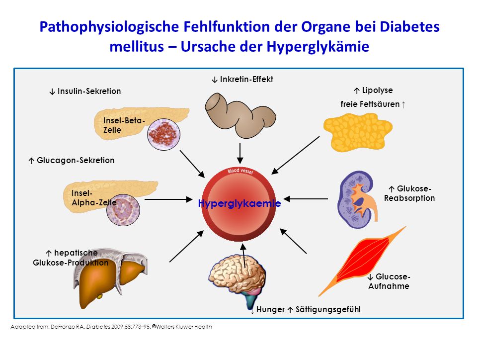 Pathophysiologische Fehlfunktion der Organe bei Diabetes mellitus – Ursache der Hyperglykämie