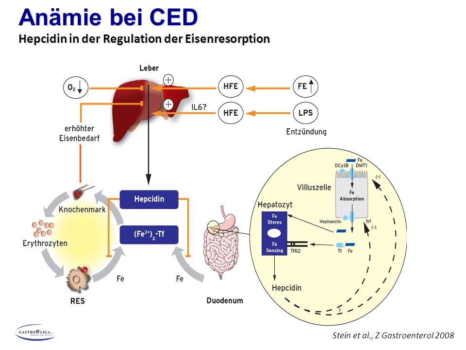 Anämie bei CED Hepcidin in der Regulation der Eisenresorption