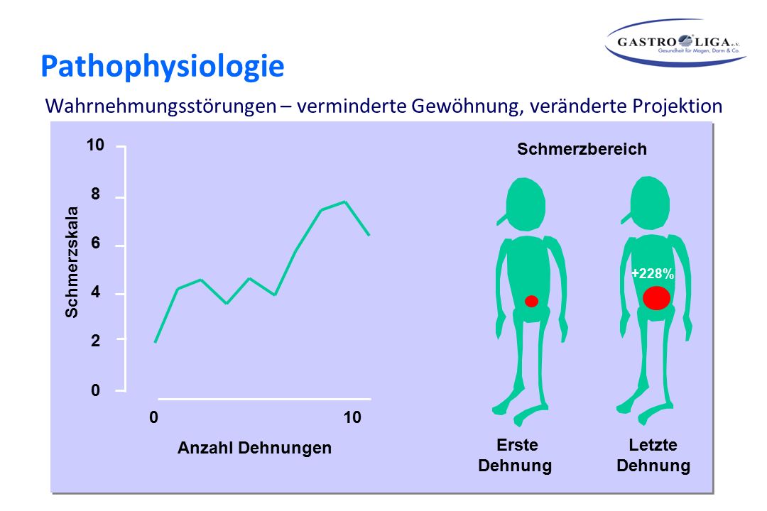 Theorien zur Pathogenese funktioneller Magen-Darmerkrankungen Wahrnehmungsstörungen – verminderte Gewöhnung, veränderte Projektion